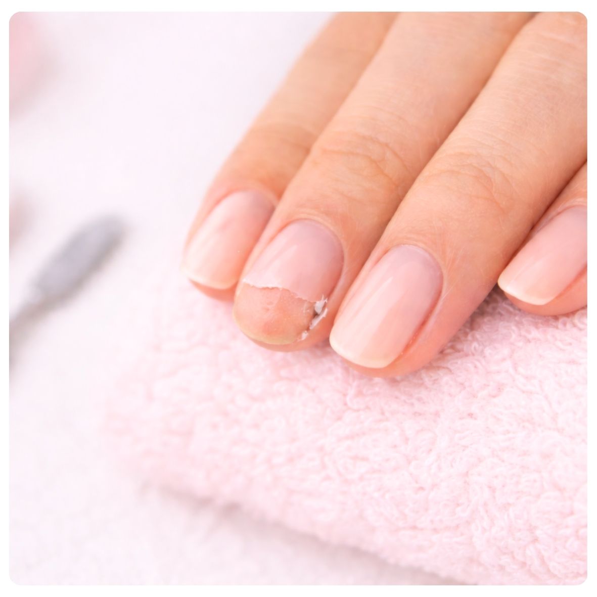 Gel Oopsie Fix – Gel Nail Repair Treatment at The Cupcake Lounge Gel Oopsie Fix treatment showing a chipped gel nail that needs repair and a refreshed, polished finish at The Cupcake Lounge.